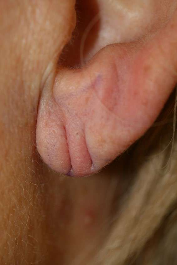 Picture1.jpg 