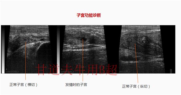 子宫不同时期超声影像.png