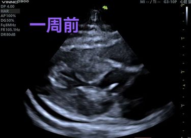 猫心包积液治疗一周后明显效果