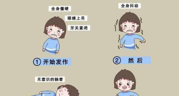 宠物也有癫痫！如何应对宠物癫痫发作？（宠物癫痫的症状、处理方法和预防措施一览）