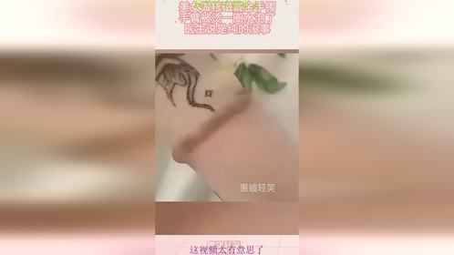 美女做核磁戴金手镯，手臂被烫一圈水泡，医生说是纯的没事