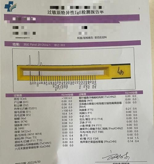 猫毛过敏该吃什么药？解析有效药物和使用方法（针对猫毛过敏的合适药物及其作用、副作用和使用注意事项）