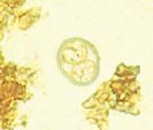 图1猫弓形虫卵囊