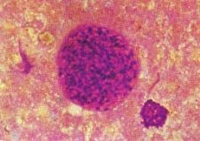 图3猫弓形虫包囊