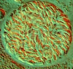 图2猫弓形虫包囊