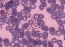 图4实验室诊断弓形虫病