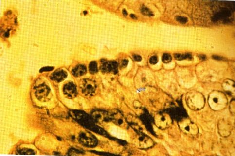 图5猫弓形虫感染