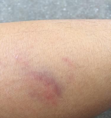 狗狗产后无出血的重要因素（了解恢复期和正确护理是关键）