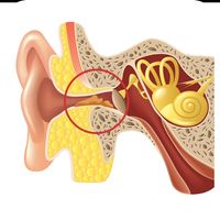 耵聍栓塞自己会脱落吗