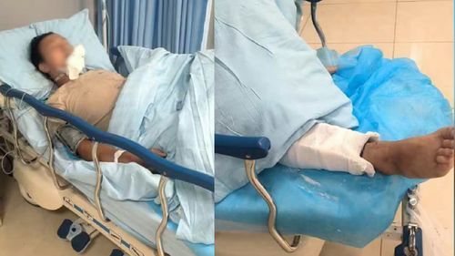 小猫骨折急救全攻略：快速处理方法