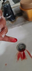 仓鼠咬了主人后的心理_仓鼠咬人原因及如何避免被咬