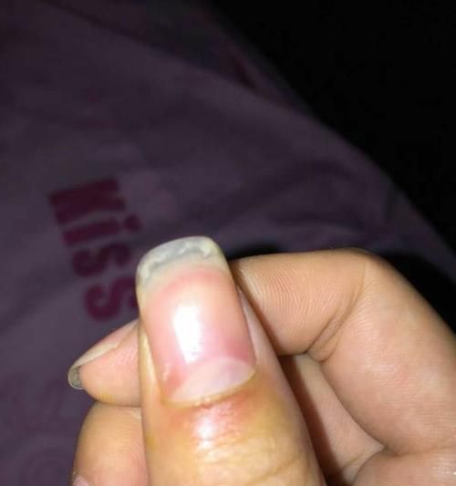 狗指甲出血应急处理方法（用药正确止血保护狗狗爪子健康）