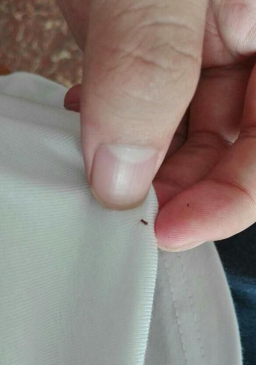 宠物猫身上的寄生虫危害（了解猫身上的寄生虫）