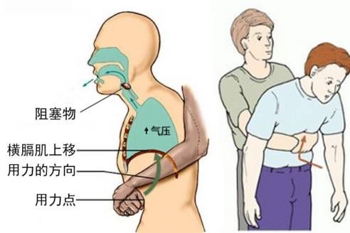 鸟食管不慎吞入，宠物急救指南！
