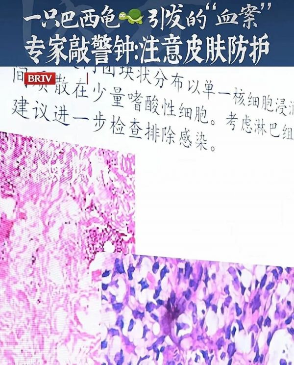 巴西龟换水不戴手套风险有多大？预防感染性肉芽肿的措施建议收藏