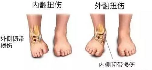 宠物脚扭伤，食疗缓解疼痛法