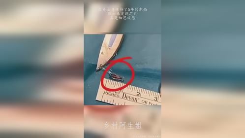 在美女身体待了5年的东西，取出来发现芯片，真是细思极恐