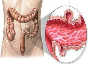 犬猫肠梗阻症状详解