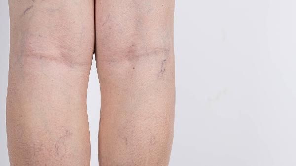 脑痉挛的症状有哪些