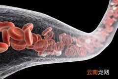 血管老化是怎么引起的 血管老化怎么形成的