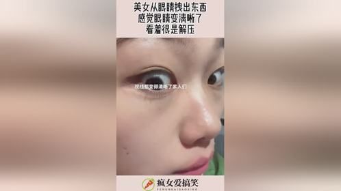 美女从眼睛拽出东西，感觉眼睛变清晰了，看着很是解压！