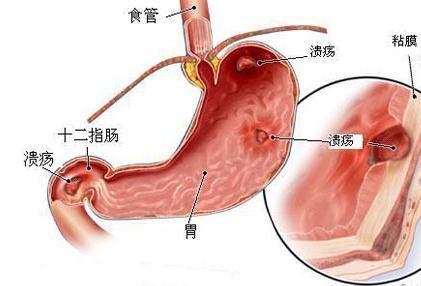宠物胃溃疡症状及治疗攻略