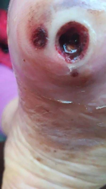 宠物截肢后伤口如何快速愈合？