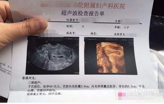 宠物怀孕后多久可以做B超呢？