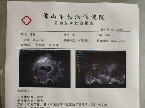 宠物怀孕后多久可以做B超呢？