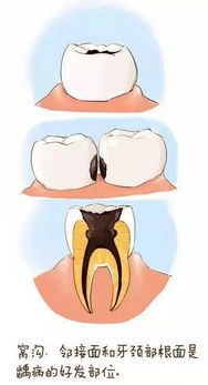 猫如何防止蛀牙的方法有哪些 - 怎么防止猫长虫