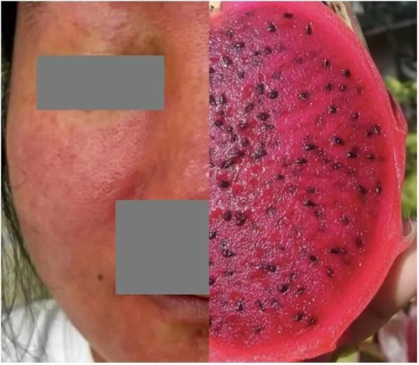 冲上热搜！女子养了这种宠物，脸烂成“火龙果”！这种宠物很多人家里都有！