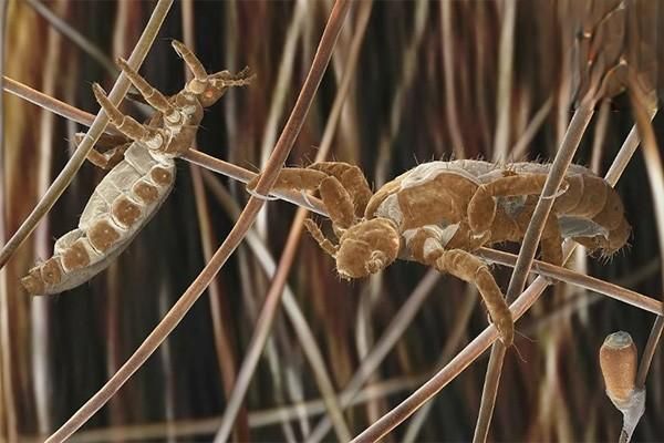 一寄生虫及真菌感染性皮肤病