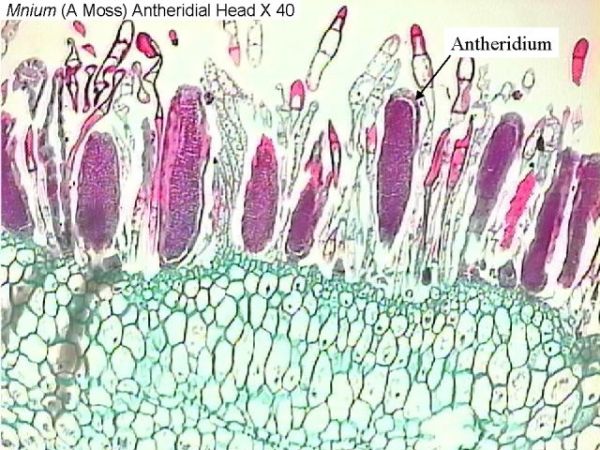 Figure 4. Mnium (a moss) antheridial head x40