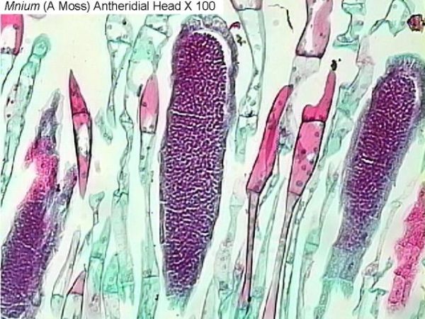 Figure 5. Mnium (a moss) antheridial head x100