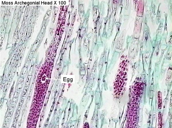 Figure 7. Moss archegonial head x 100