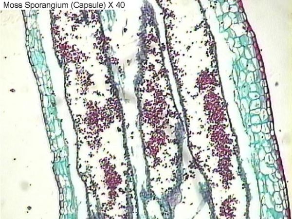 Figure 9. Moss capsule x40