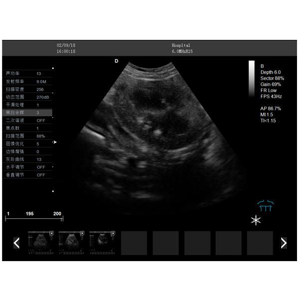 宠物彩超机多少钱一台