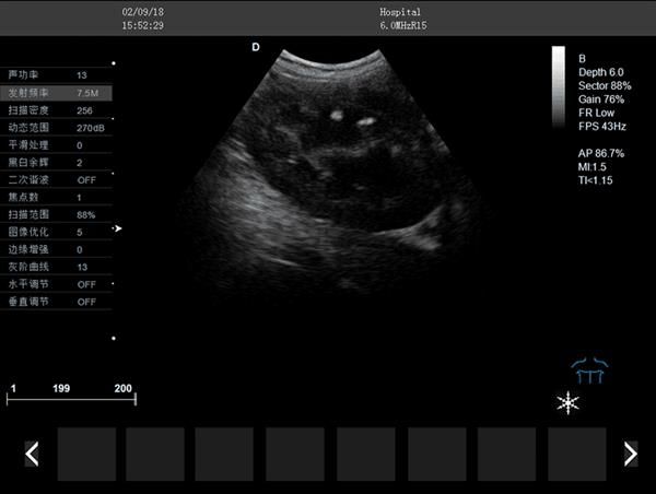 宠物彩色超声诊断仪图像