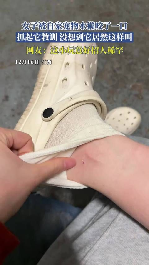 女子遭宠物水獭咬伤后反被其叫声萌化