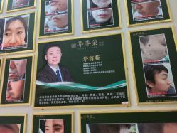 -华尊荣植物古法祛痣祛疣祛汗管瘤