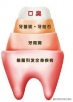 狗子有必要洗牙吗？揭秘宠物超声波洁牙全过程！