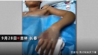 13岁男孩攒钱网购宠物蛇，玩蛇被咬进ICU，医生：买的是竹叶青