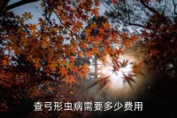 弓形虫检查需要多少钱，查弓形虫病需要多少费用