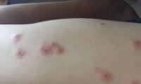 如何治疗八哥犬身上的红疙瘩（宠物健康必须知道的8个关键点）