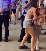 重庆女童遭阿拉斯加犬撕咬！现场画面曝光，狗主人在一旁打电话？