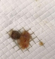 小狗身上的蛔虫引发的健康问题（以小狗拉出来的蛔虫为例，分析宠物身上蛔虫带来的影响及预防方法）