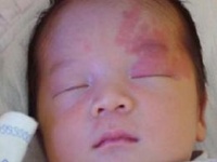 宠物痣诊断与护理指南