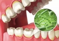 宠物口腔健康，识牙菌斑危害