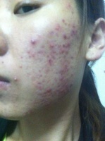 宠物脸破皮急救处理