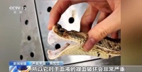 男子养五步蛇当宠物，蛇生病无法主动进食，男子用手喂养被咬后截肢，专家提醒